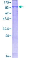 Human KEAP1 Protein (Recombinant GST)