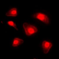 Polyclonal Rabbit anti-Human FOXO1 / FKHR Antibody (phospho-Ser329, IHC, IF, WB)