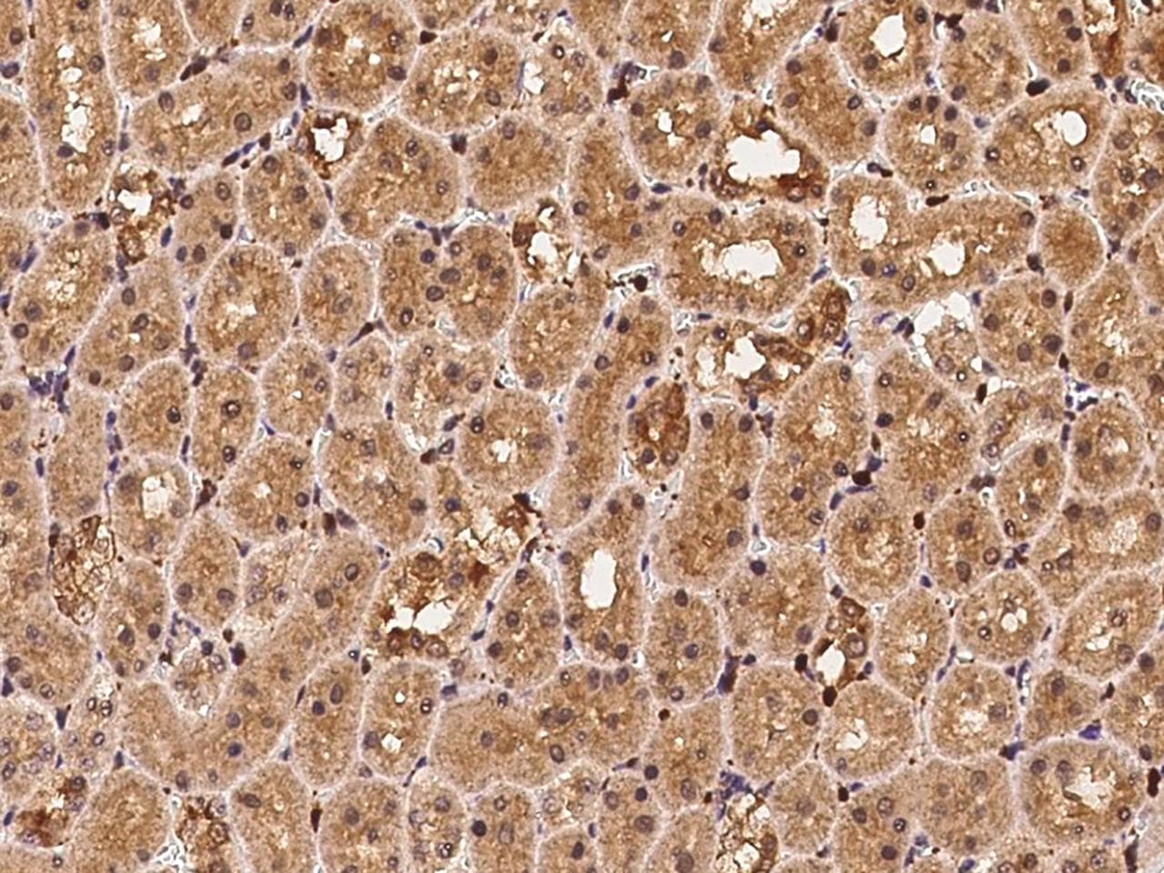 PFN1 / Profilin 1 Antibody