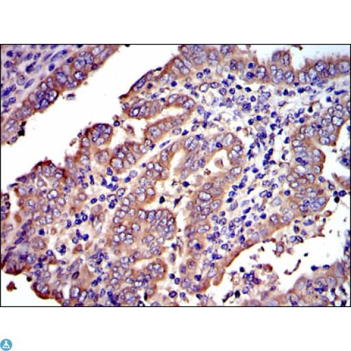 CRK Antibody