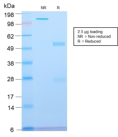 Recombinant Monoclonal Rabbit anti-Human SPTBN2 Antibody (clone SPTBN2/2894R, aa356-475, IHC, WB)