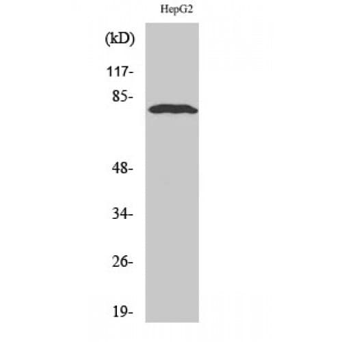 ADAR2 / ADARB1 Antibody (450-530 aa, Internal)