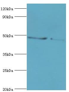 SMYD3 Antibody (aa199-428)