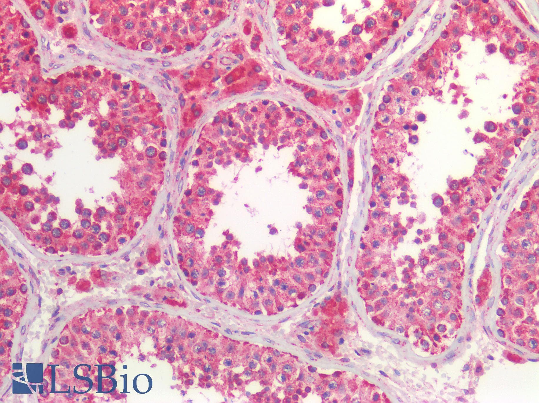 IHC-plus™ HADHA Antibody