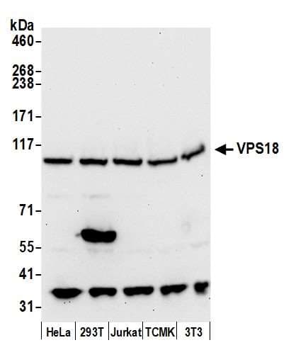 VPS18 Antibody (aa1-50)