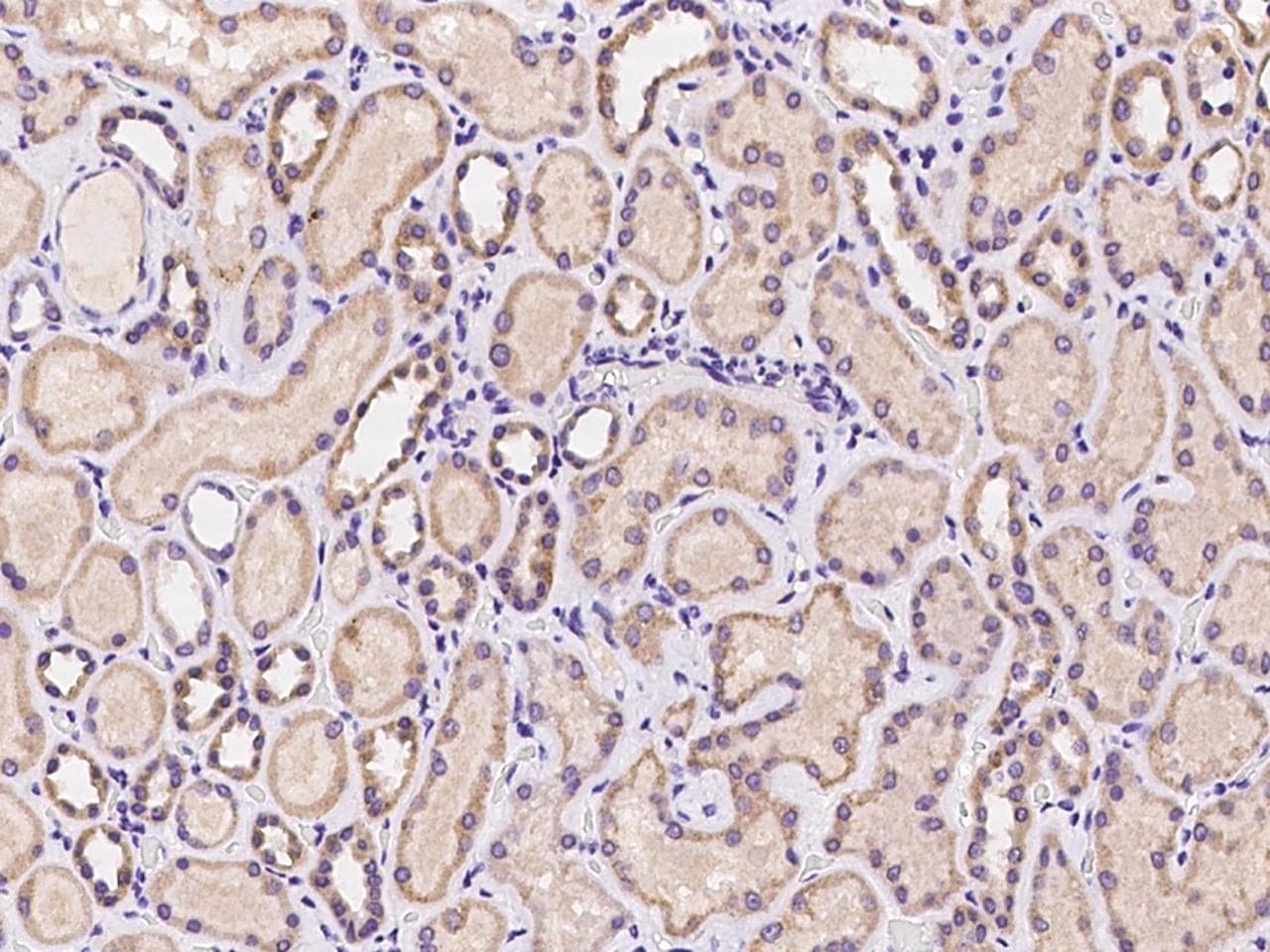 ZP2 Antibody