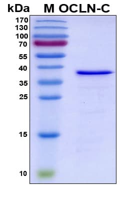 Human OCLN / Occludin Protein (Recombinant His, N-Terminal)
