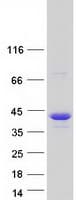 Human NUP35 / NUP53 Protein (Recombinant Myc-DDK (Flag))