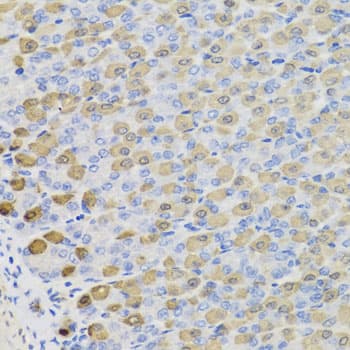 LDHB / Lactate Dehydrogenase B Antibody