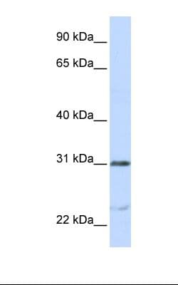 NUSAP1 / NUSAP Antibody (aa360-409)