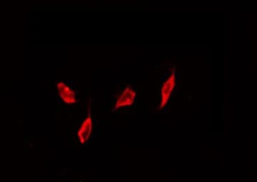 BIRC5 / Survivin Antibody (phospho-Thr117)