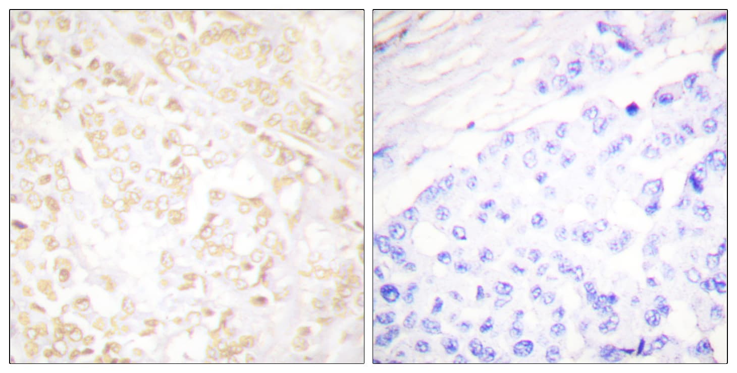 XRCC6 / Ku70 Antibody (aa554-603)