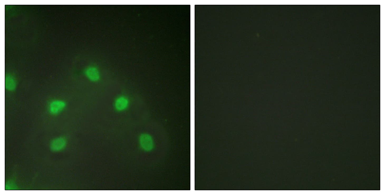IHC-plus™ HNRNPL / hnRNP L Antibody (aa61-110)