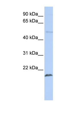 Polyclonal Rabbit anti-Human ZNF79 Antibody (N-Terminus, WB)