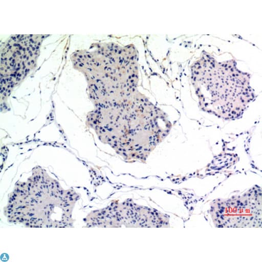THBS2 / Thrombospondin 2 Antibody