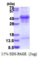Human KLF6 Protein (Recombinant His)