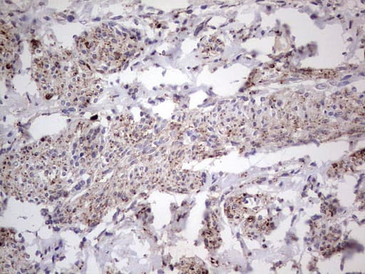 Monoclonal Mouse anti-Human PKM2 Antibody (clone 11B11, IHC, WB)