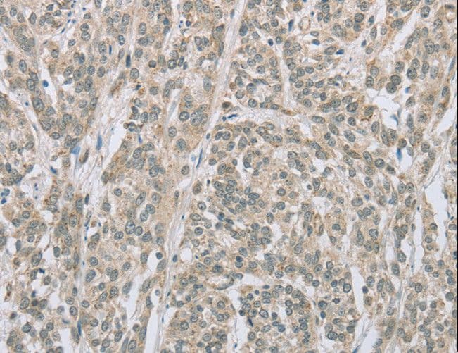 EDA2R / XEDAR Antibody