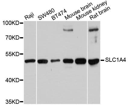 SLC1A4 / ASCT1 Antibody