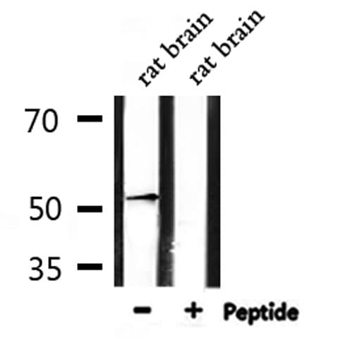 ADRA1A Antibody