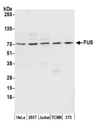 Polyclonal Rabbit anti-Human FUS / TLS Antibody (aa400-450, IHC, WB)