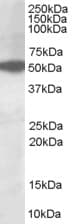 IHC-plus™ AKT3 Antibody (aa119-133)