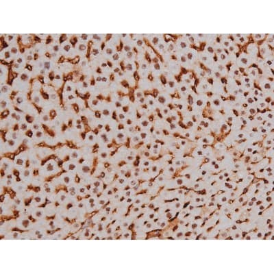 Polyclonal Rabbit anti-Human MAPT / Tau Antibody (phospho-Thr205, IHC, WB)