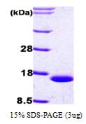 Human FABP1 / L-FABP Protein (Recombinant His)