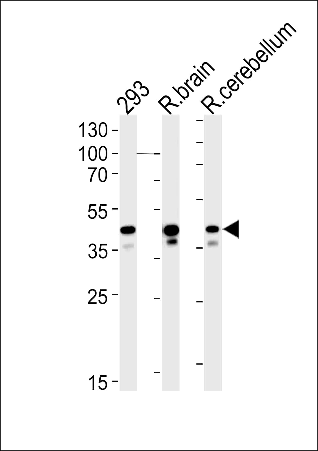 CSNK2A1 Antibody (aa28-50)