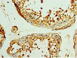 CCN5 Antibody (aa1-250)