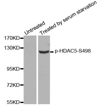 HDAC5 Antibody (phospho-Ser498)