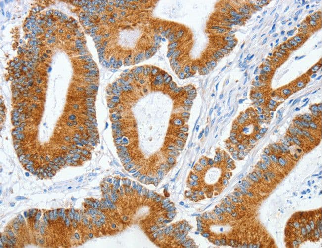 MANF / ARMET Antibody