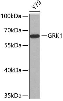 Rhodopsin Kinase / GRK1 Antibody