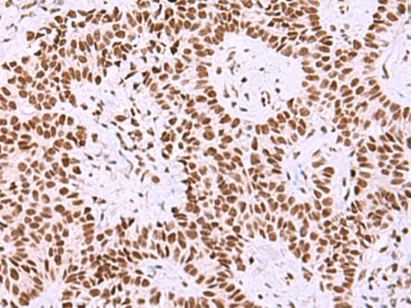 ISY1-RAB43 Antibody