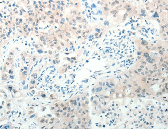 RAB25 Antibody