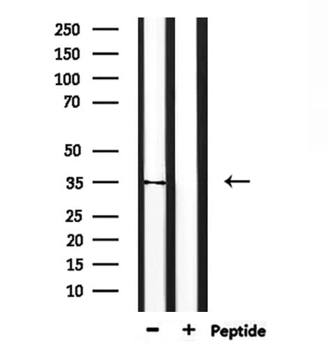 Polyclonal Rabbit anti-Human TAS2R31 / T2R31 Antibody (WB)
