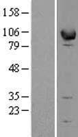 EPB41L1 / 4.1N Protein (Over-Expression Lysate Myc-DDK (Flag))