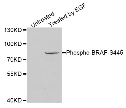 Polyclonal Rabbit anti-Human BRAF / B-Raf Antibody (phospho-Ser445, WB)