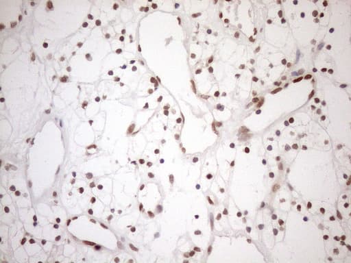 Monoclonal Mouse anti-Human MGMT Antibody (clone OTI2F10, IHC, WB)