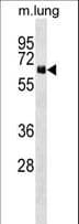NET1 / ARHGEF8 Antibody (aa356-385)