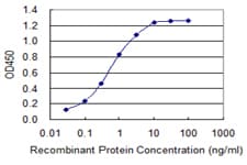 IHC-plus™ SLC5A2 / SGLT2 Antibody (clone 3G8)