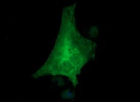 TH / Tyrosine Hydroxylase Antibody (clone OTI1A12)