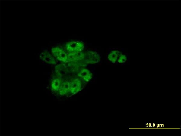 IHC-plus™ Monoclonal Mouse anti-Human RARA / RAR Alpha Antibody (clone 2C9-1F8, IHC, IF, WB)