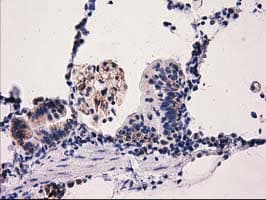P5CR2 / PYCR2 Antibody (clone OTI2A12, Carrier-free)