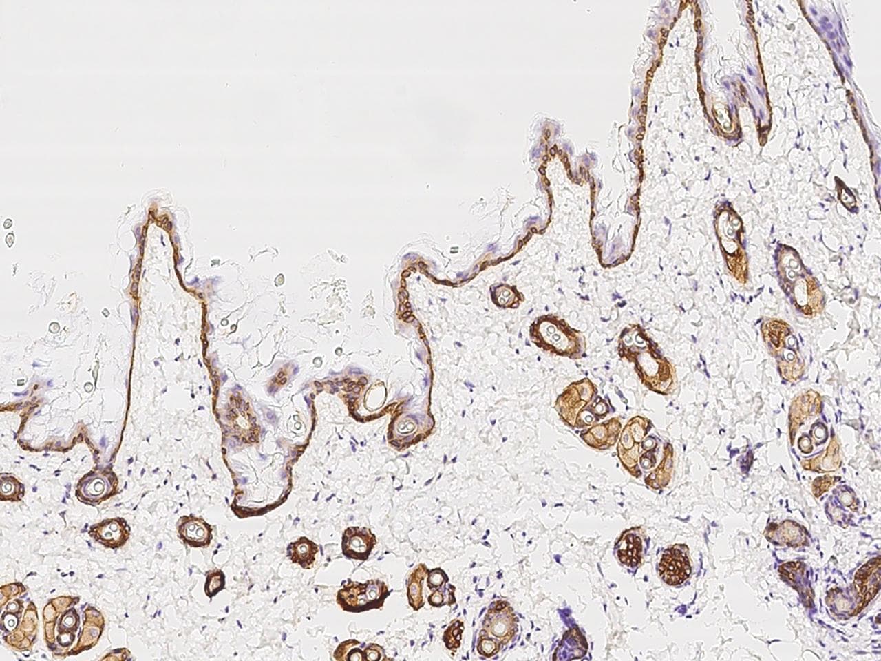 KRT14 / CK14 / Cytokeratin 14 Antibody (Preservative Free)