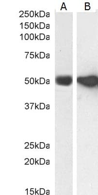 PathPlus™ GFAP Antibody (aa417-430)