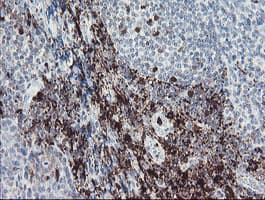 F13A1 / Factor XIIIa Antibody (clone OTI3E3, Carrier-free)