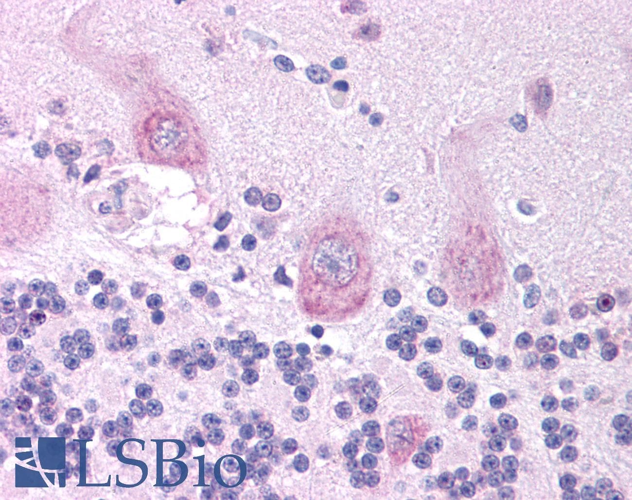Polyclonal Rabbit anti-Human CHRNA3 Antibody (aa26-75, IHC, WB)
