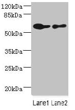 Polyclonal Rabbit anti-Human CHRNA6 Antibody (IHC, WB)