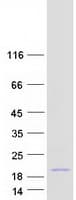 Human IL2 Protein (Recombinant Myc-DDK (Flag))